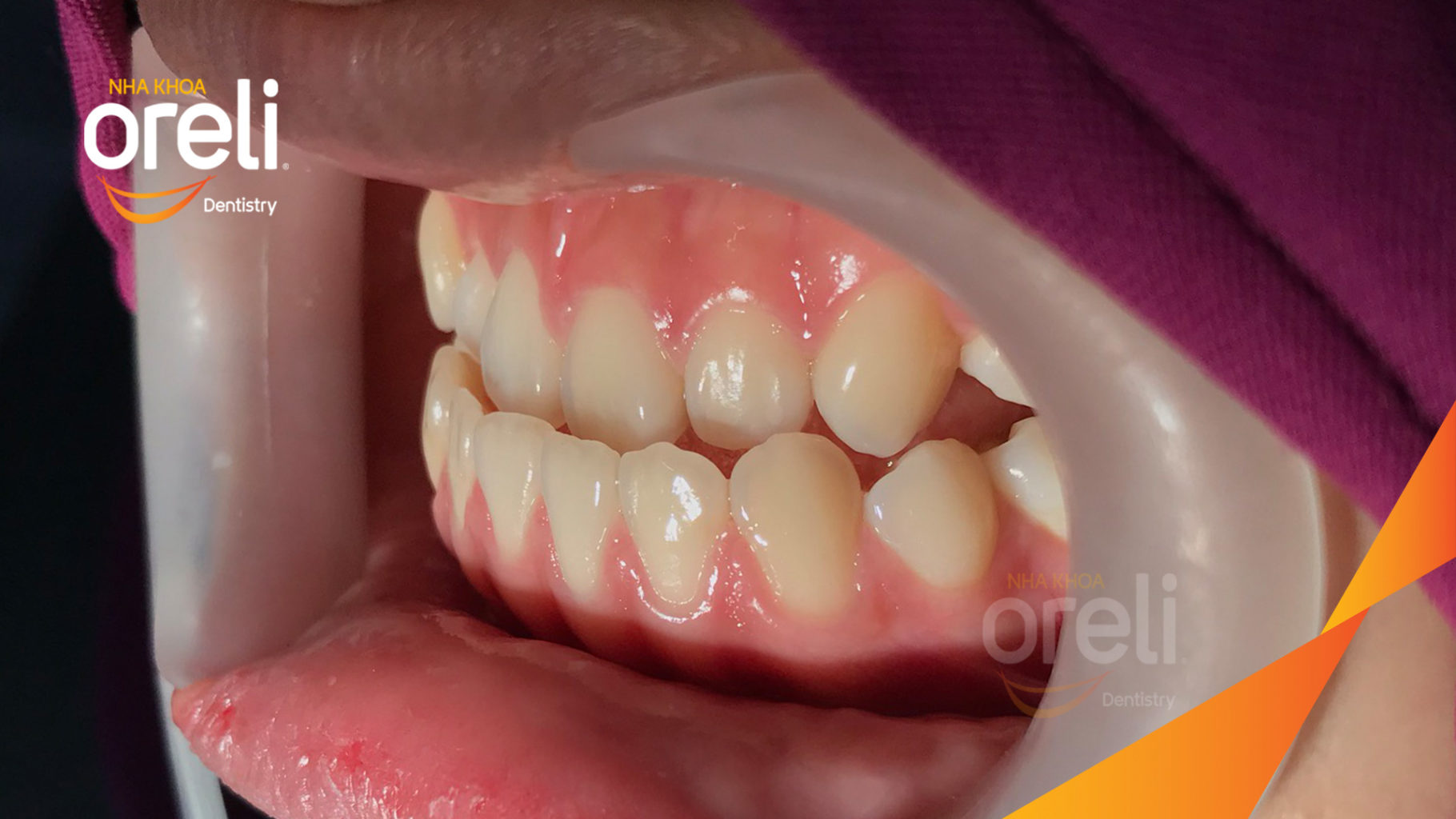 nieng rang uy tin bmt daklak