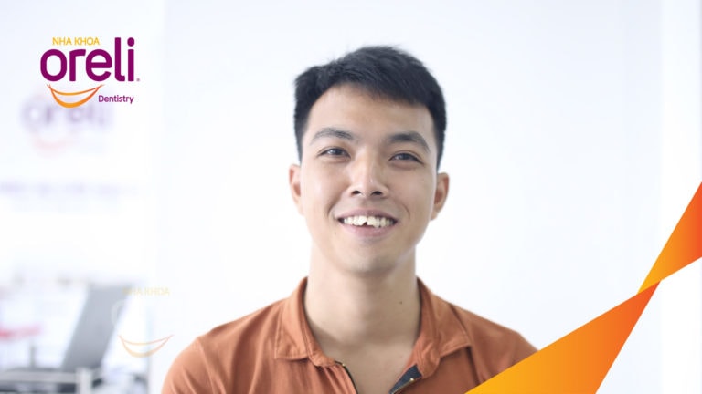 Ca niềng chỉnh cắn hở không nhổ răng kết quả thực tế tại nha khoa Oreli
