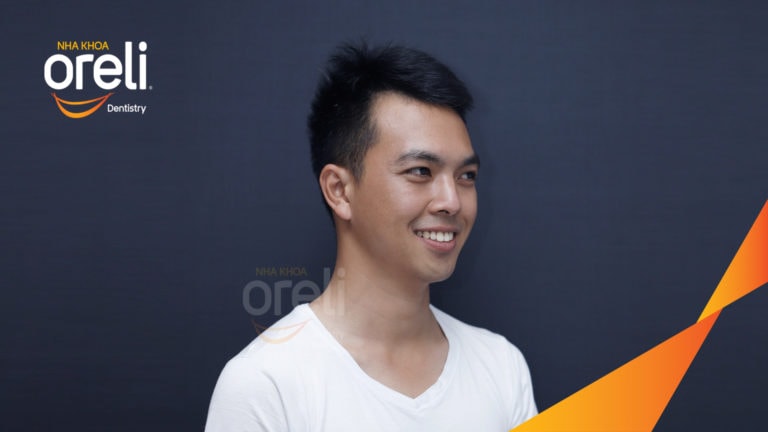 Ca niềng chỉnh cắn hở không nhổ răng kết quả thực tế tại nha khoa Oreli