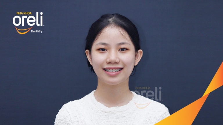 nieng rang ho oreli bmt bs nam chung