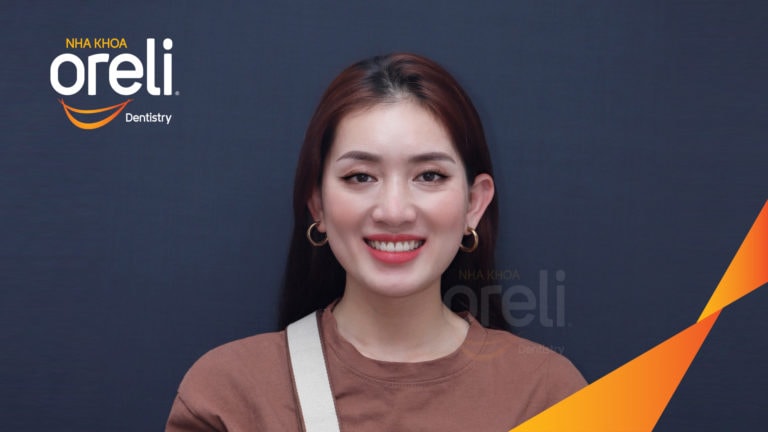 Tháo mắc cài ca chỉnh nha lại tiếp tục đóng khoảng chỉnh hô tại Oreli