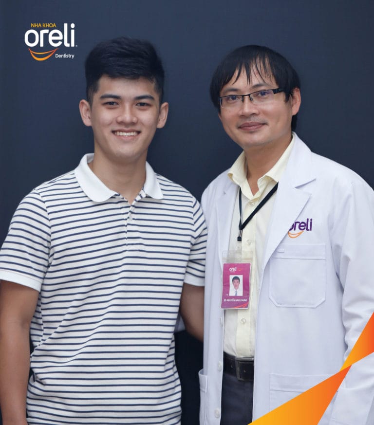 Ca niềng răng sai khớp cắn hạng 3 móm chen chúc kèm di gần răng số 7 8 thay thế răng 6 ở Oreli