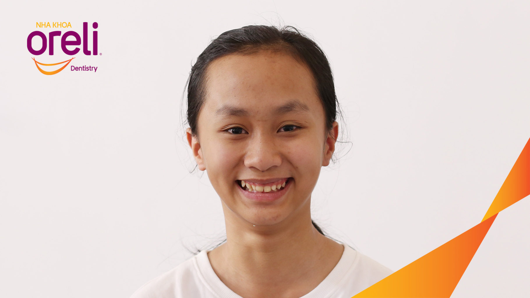 nieng rang oreli uy tin bmt bs chung