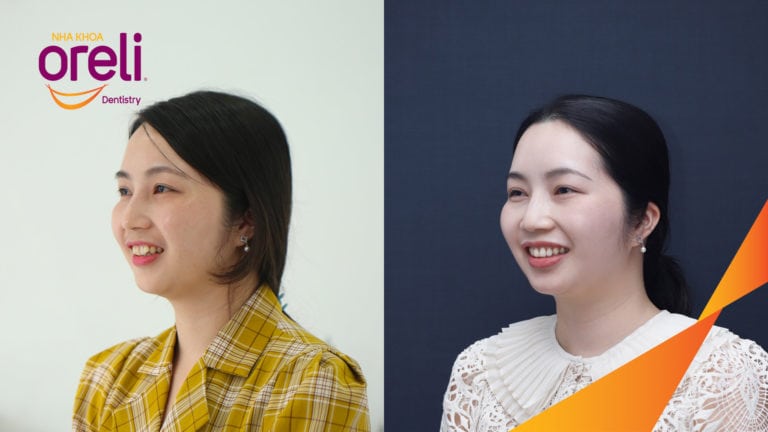 nieng rang chuan oreli bmt bs chung