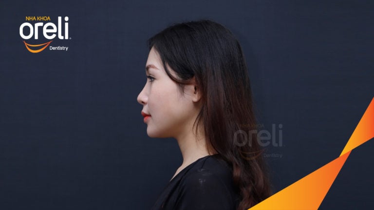 nieng rang uy tin daklak bs nam chung