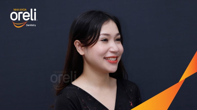 Ca niềng khe thưa bằng mắc cài sứ kết quả thay đổi sau 18 tháng tại nha khoa Oreli