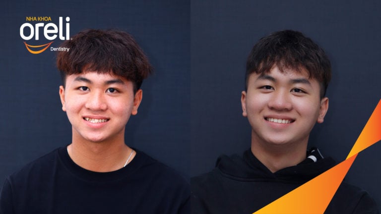 nieng rang mot hamn tren