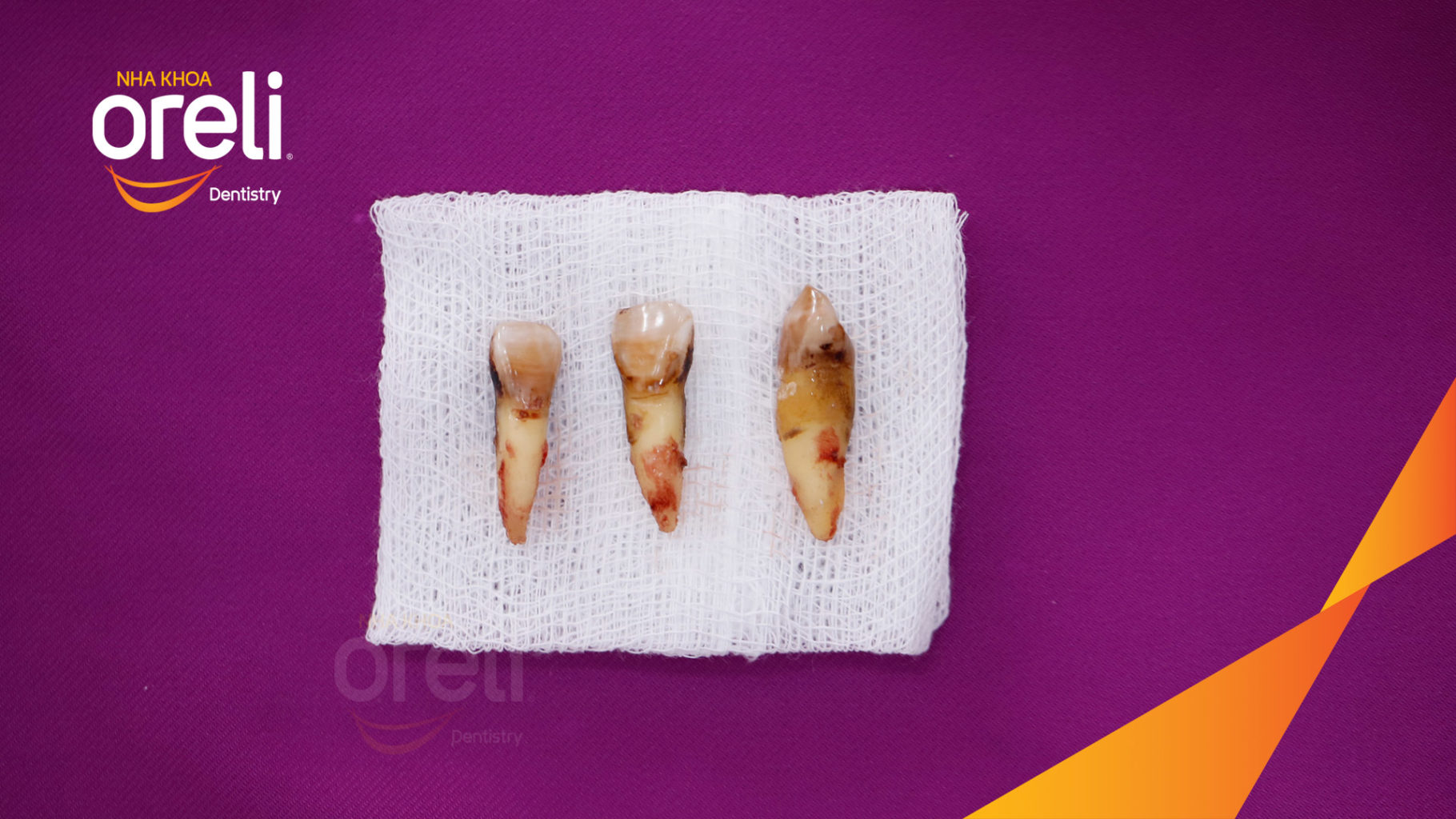 Quá trình  trong  tại Oreli