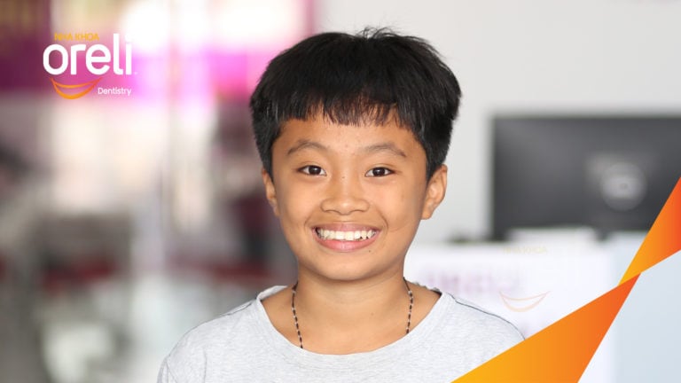 Niềng răng hô nhổ 4 răng số 4 – Trước & sau thực tế tại Buôn Ma Thuột