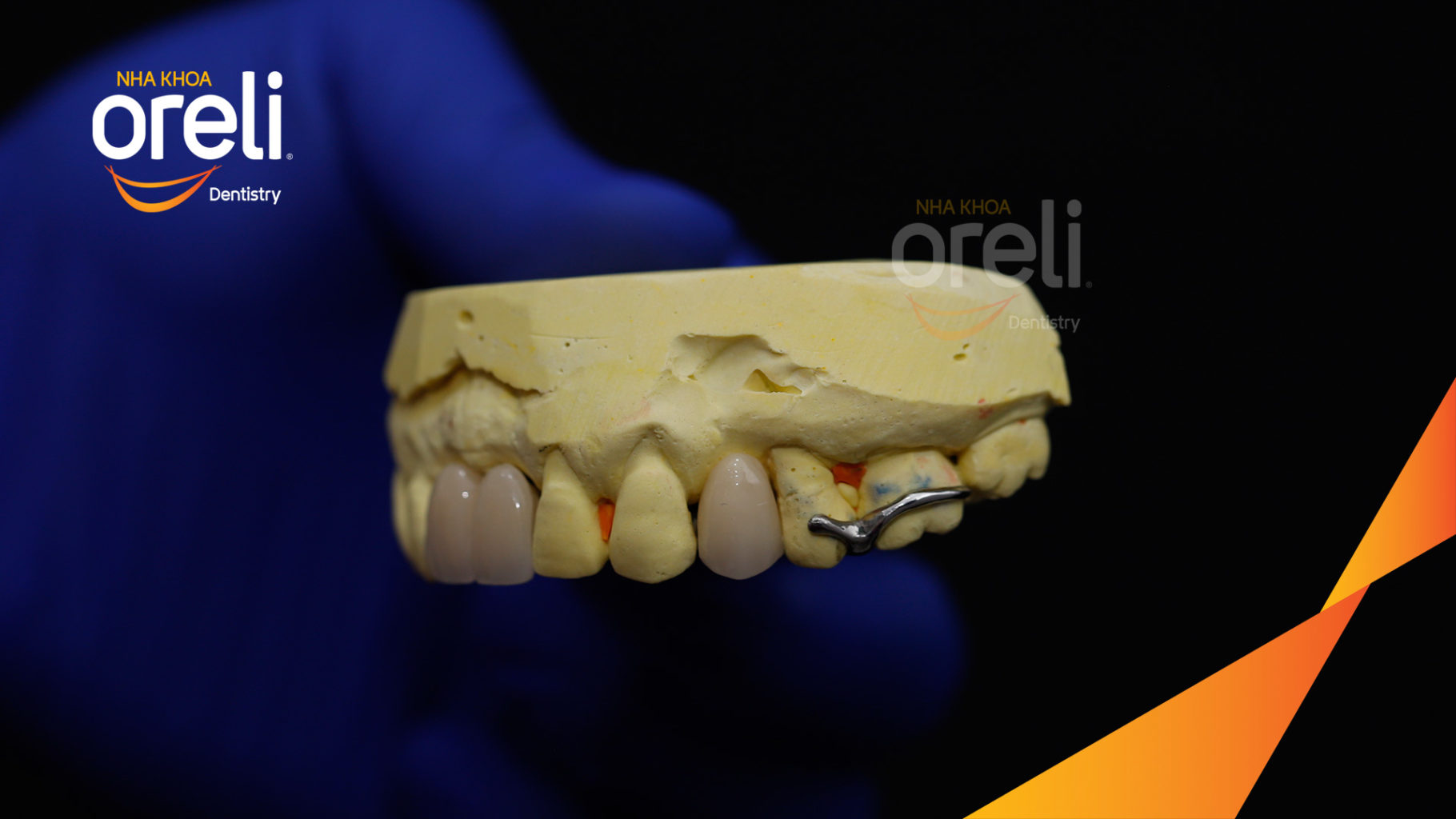 thao lap ham khung oreli