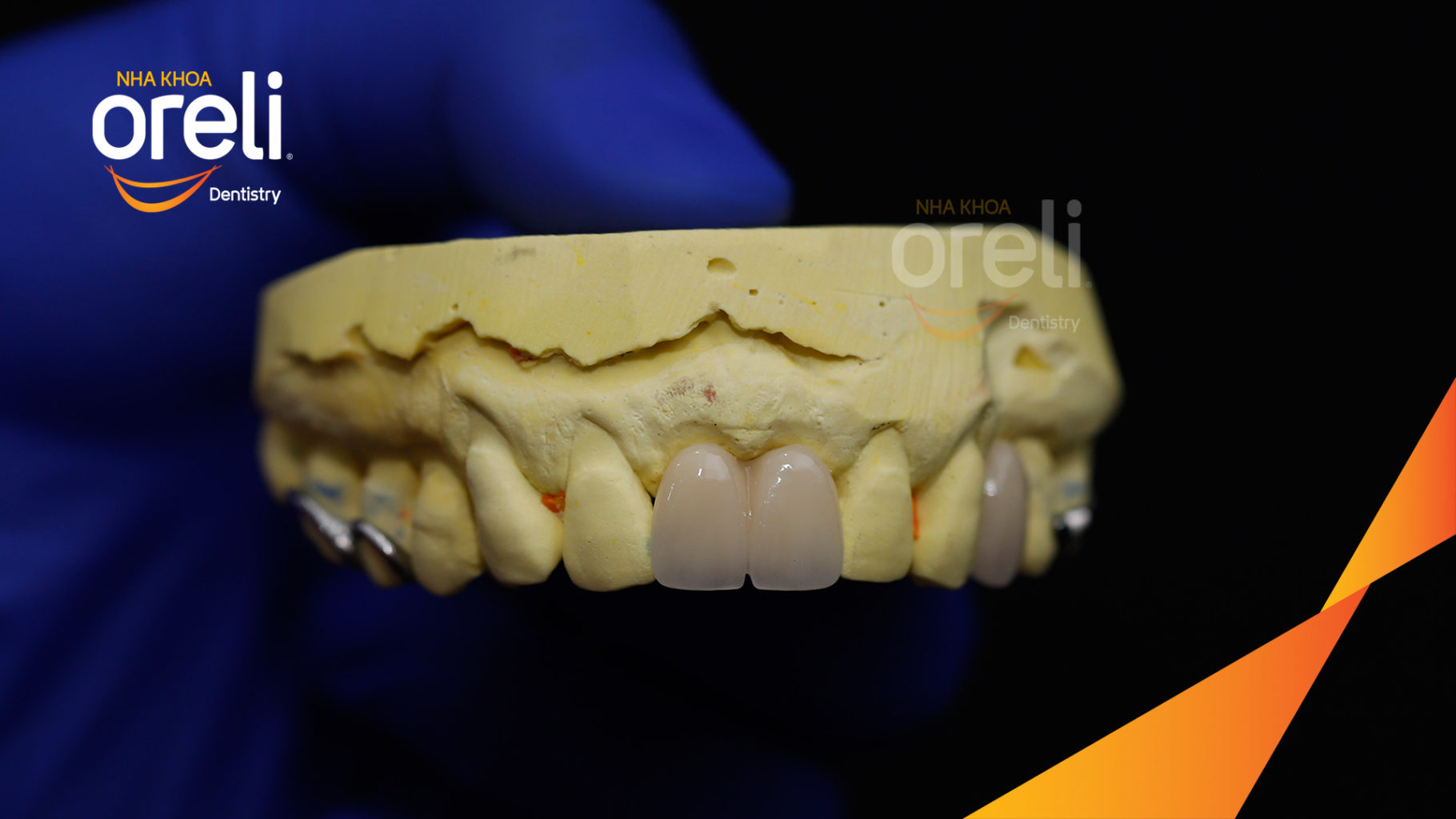 thao lap ham khung oreli