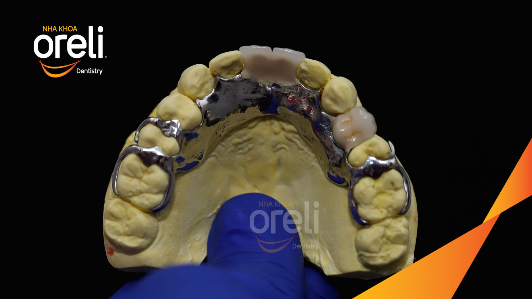 thao lap ham khung oreli