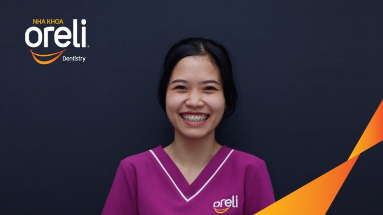 Ca niềng chỉnh cười hở nướu khe thưa kết quả sau 2 năm tại nha khoa Oreli