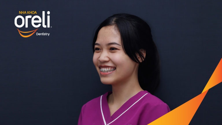 Ca niềng chỉnh cười hở nướu khe thưa kết quả sau 2 năm tại nha khoa Oreli