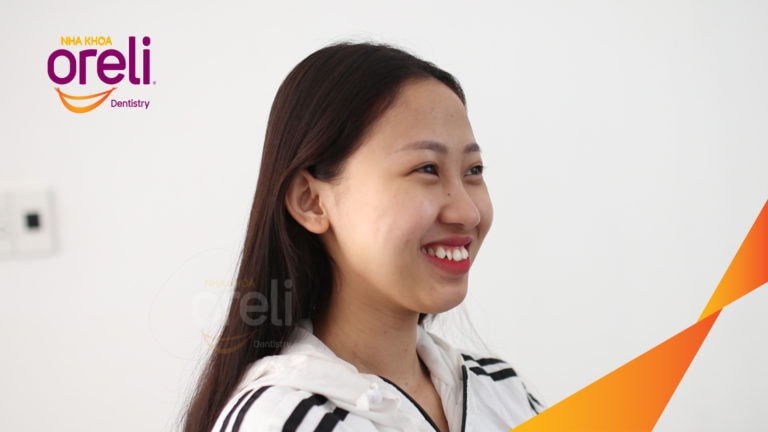Ca niềng chỉnh hô nhổ 4r4 cho nụ cười hài hòa kết quả thực tế tại Oreli