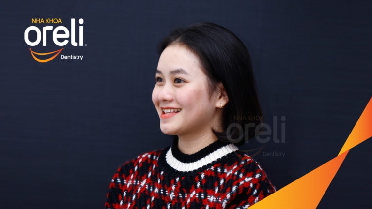 Ca niềng chỉnh móm nặng kết quả thực tế tại Nha khoa Oreli