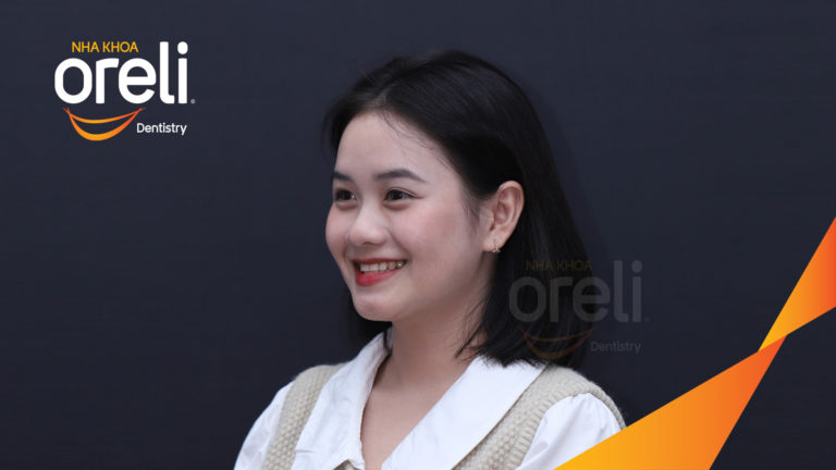 Ca niềng chỉnh móm nặng kết quả thực tế tại Nha khoa Oreli