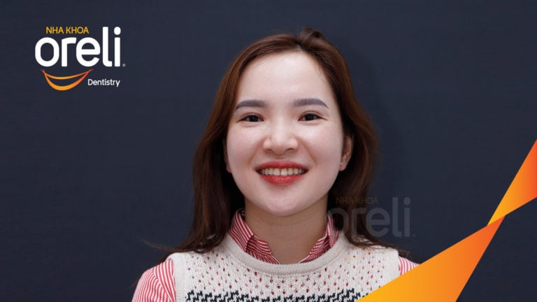 Ca niềng răng hô chen chúc có nhổ 4r4 kết quả sau 3 năm tại Oreli
