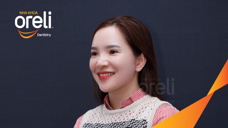 Ca niềng răng hô chen chúc có nhổ 4r4 kết quả sau 3 năm tại Oreli