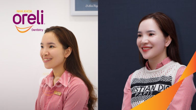 nieng rang dep oreli