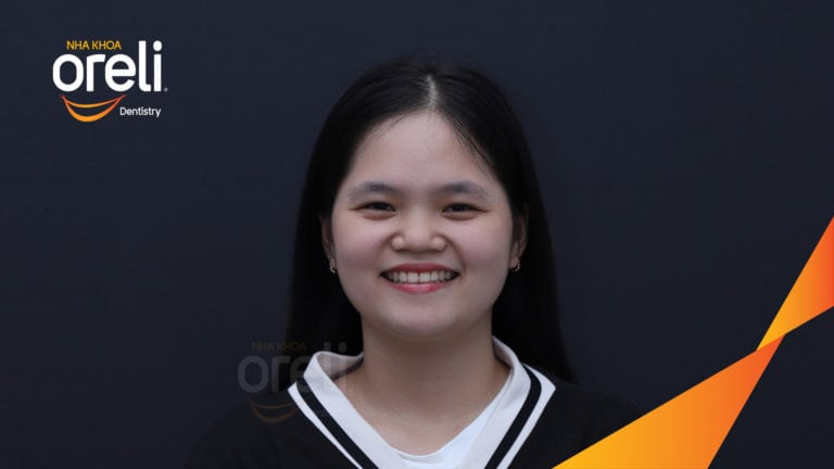 Ca niềng chỉnh hô kết quả sau hơn hai năm tại nha khoa Oreli