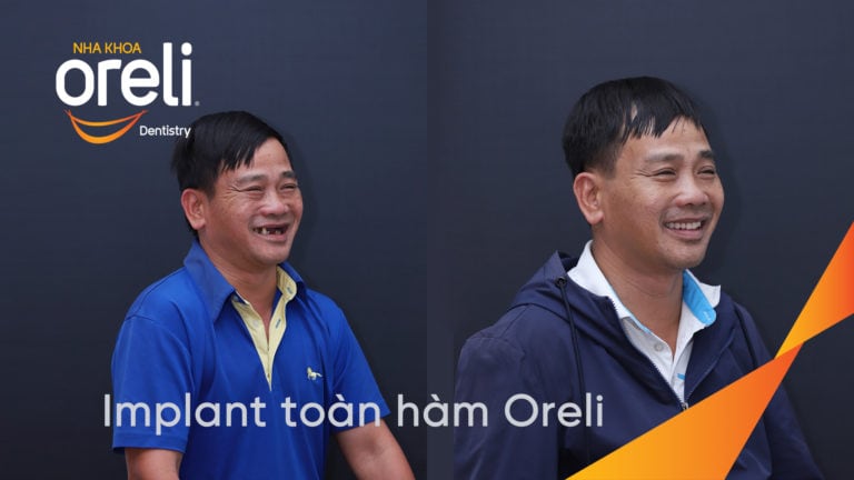 cay ghep rang toan ham oreli