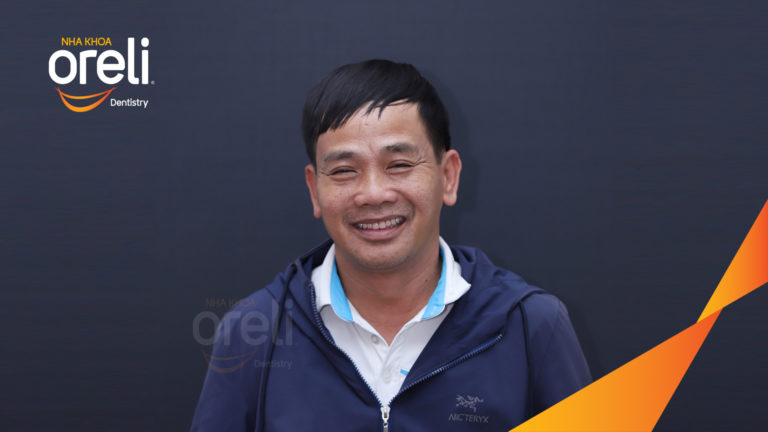 Trồng răng all on four hàm trên và dưới – Khôi phục ăn nhai trở lại | Oreli