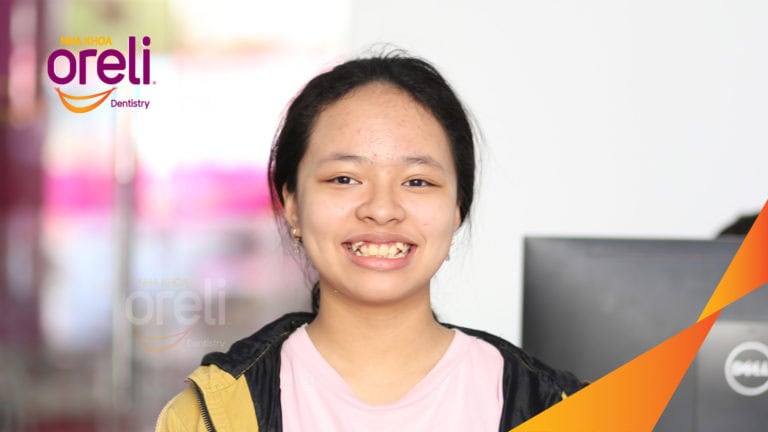 nieng rang ho chen chuc oreli