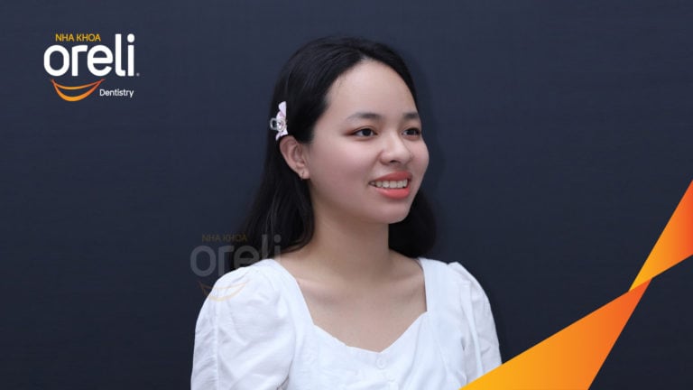 Ca cắn sâu lùi cằm răng chen chúc kết quả sau 3 năm niềng răng