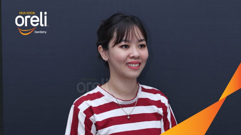 Niềng chỉnh hô và di gần răng 7 8 thay thế răng 6 kết quả thực tế tại Oreli