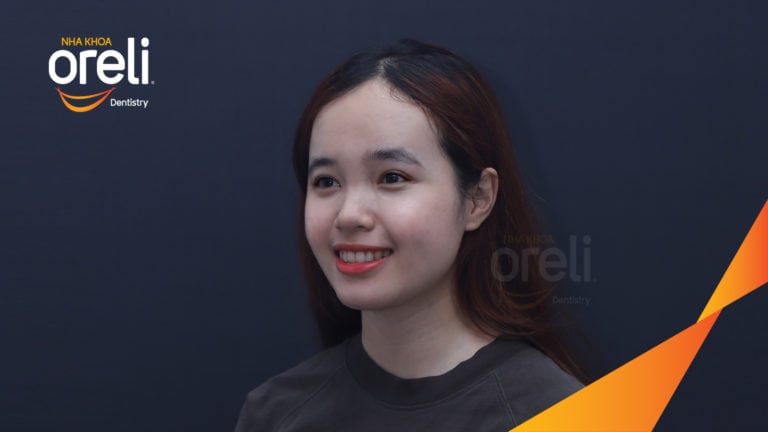 Chỉnh hô bằng niềng răng – cải thiện góc nghiêng và khớp cắn tại Oreli
