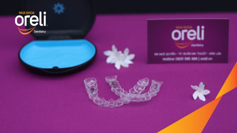 chinh nha trong suot bmt