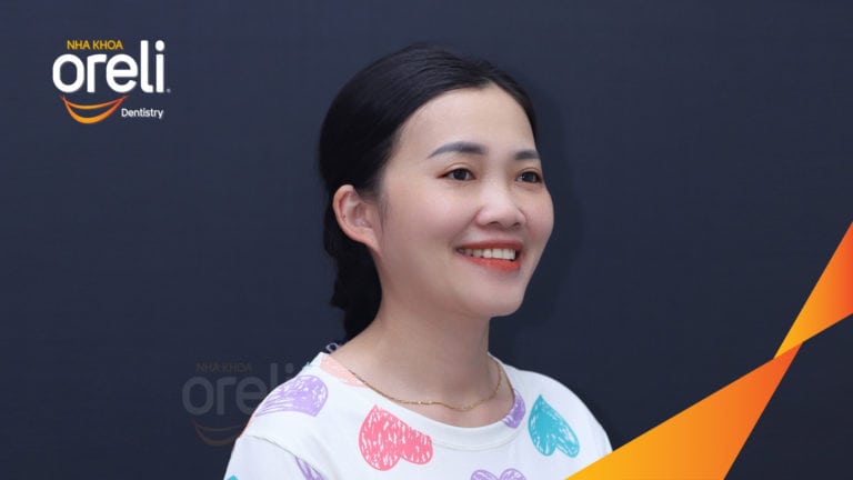 Ca niềng chỉnh sai khớp cắn hạng 3 móm nặng kèm chen chúc kết quả thực tế sau 3 năm