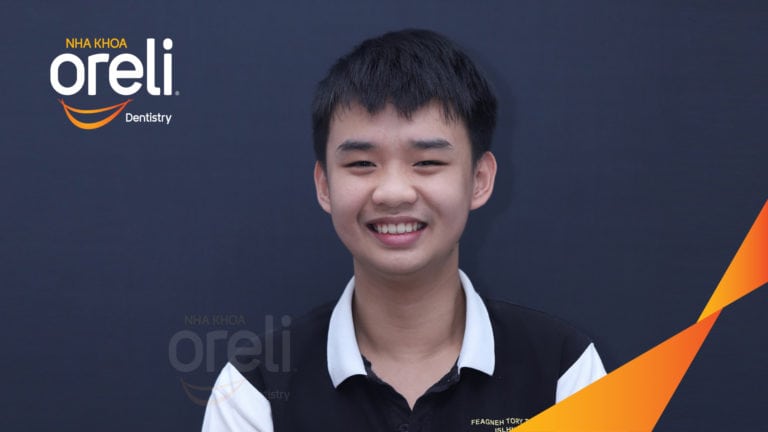 Ca niềng chỉnh chen chúc và cắn sâu nặng kết quả sau 2 năm tại nha khoa Oreli