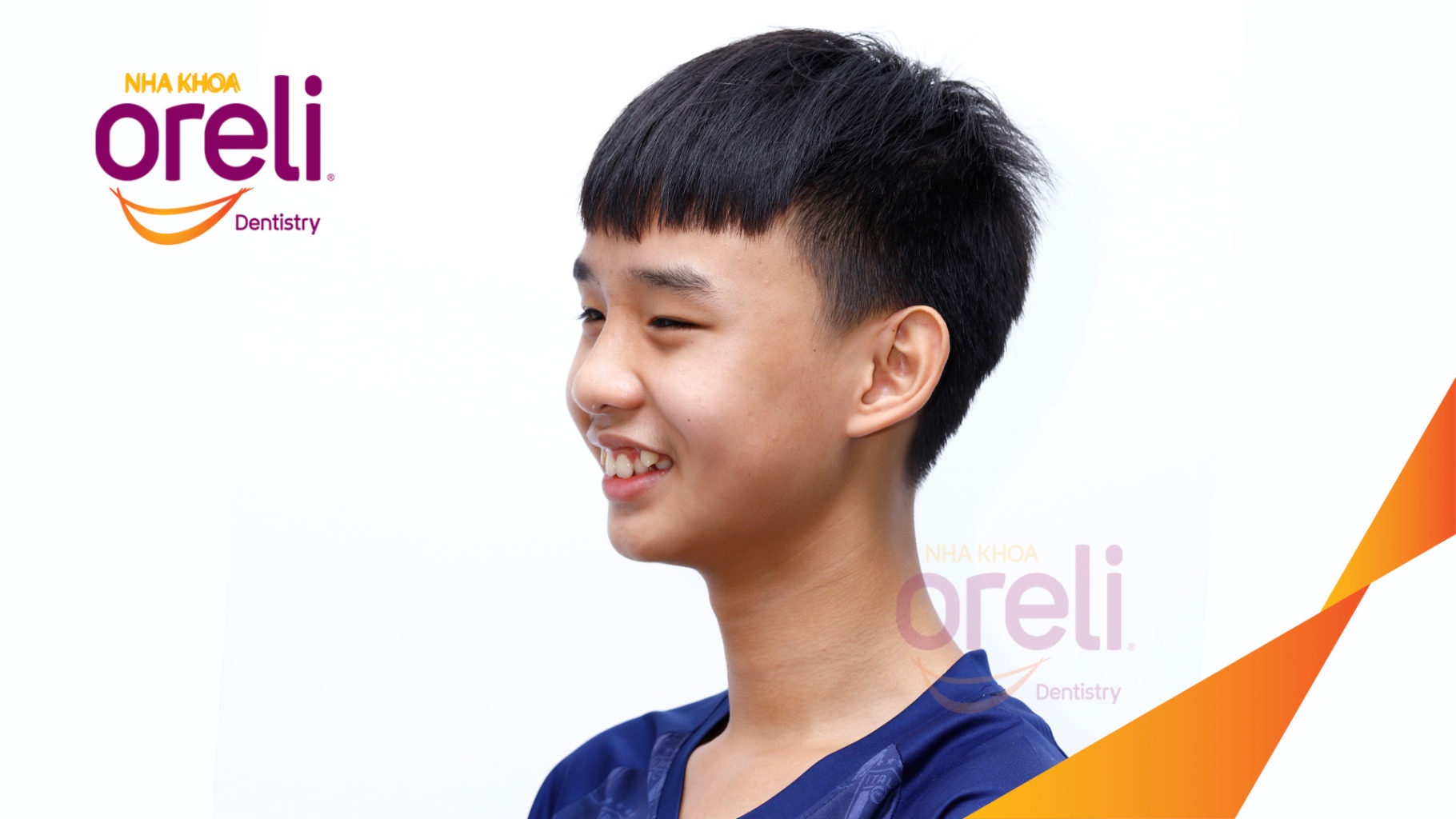 Trước điều trị:  tại Oreli