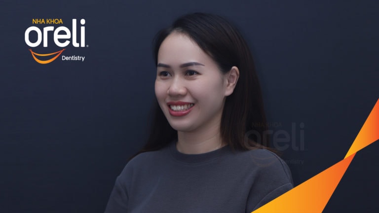 Ca niềng chỉnh hô không nhổ răng 4 tại Oreli