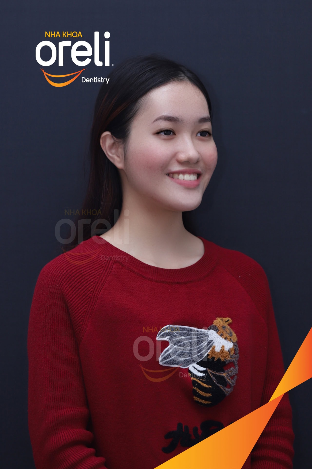 nieng rang mom chen chuc co nho rang o oreli