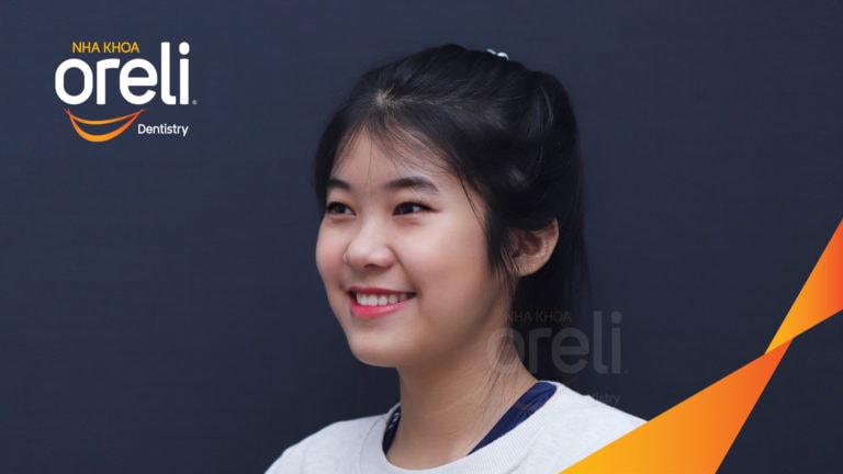 Niềng răng móm hạng 3 nặng – Kết quả sau 24 tháng tại Nha khoa Oreli
