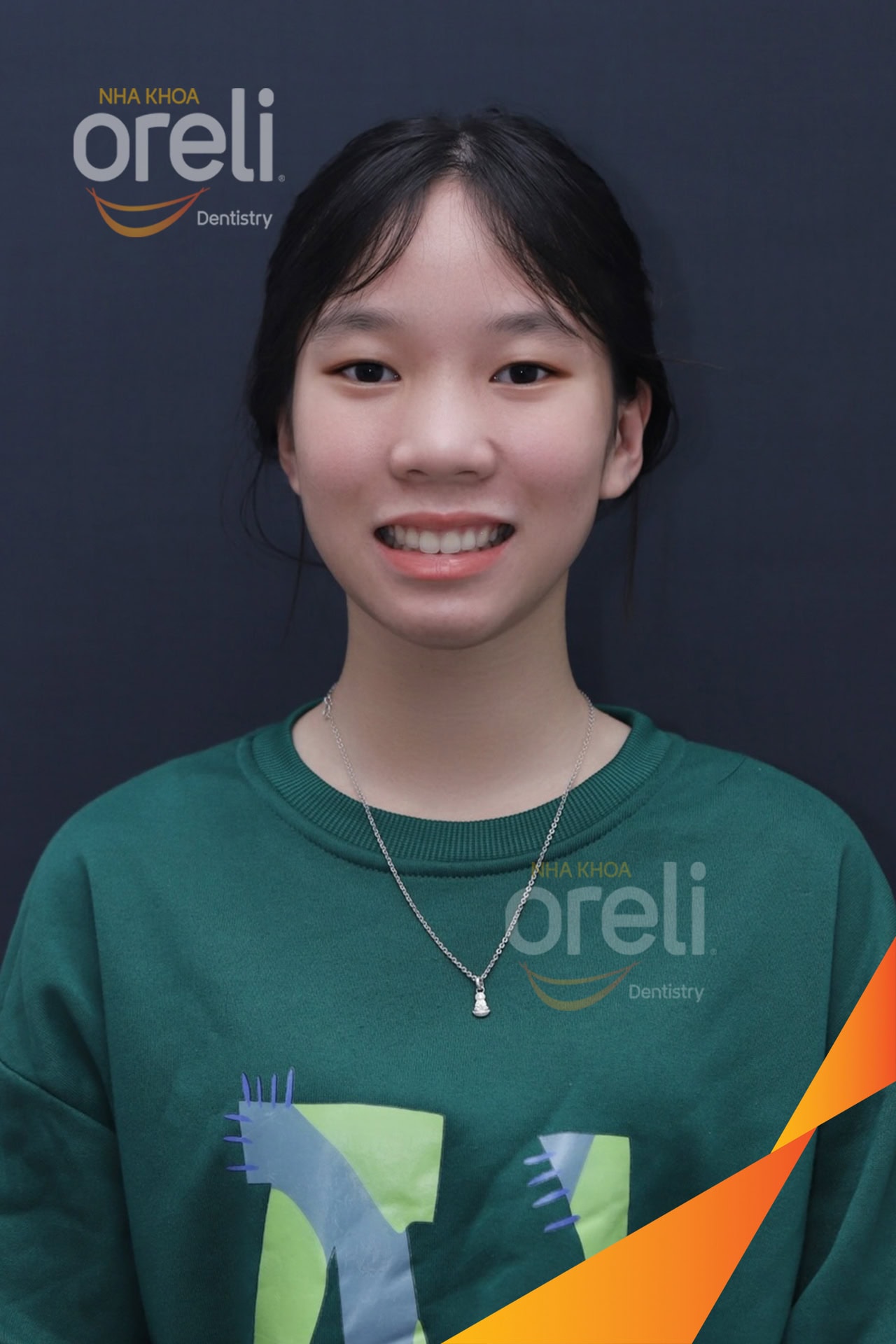 nieng chinh ho uy tin daklak nha khoa Oreli