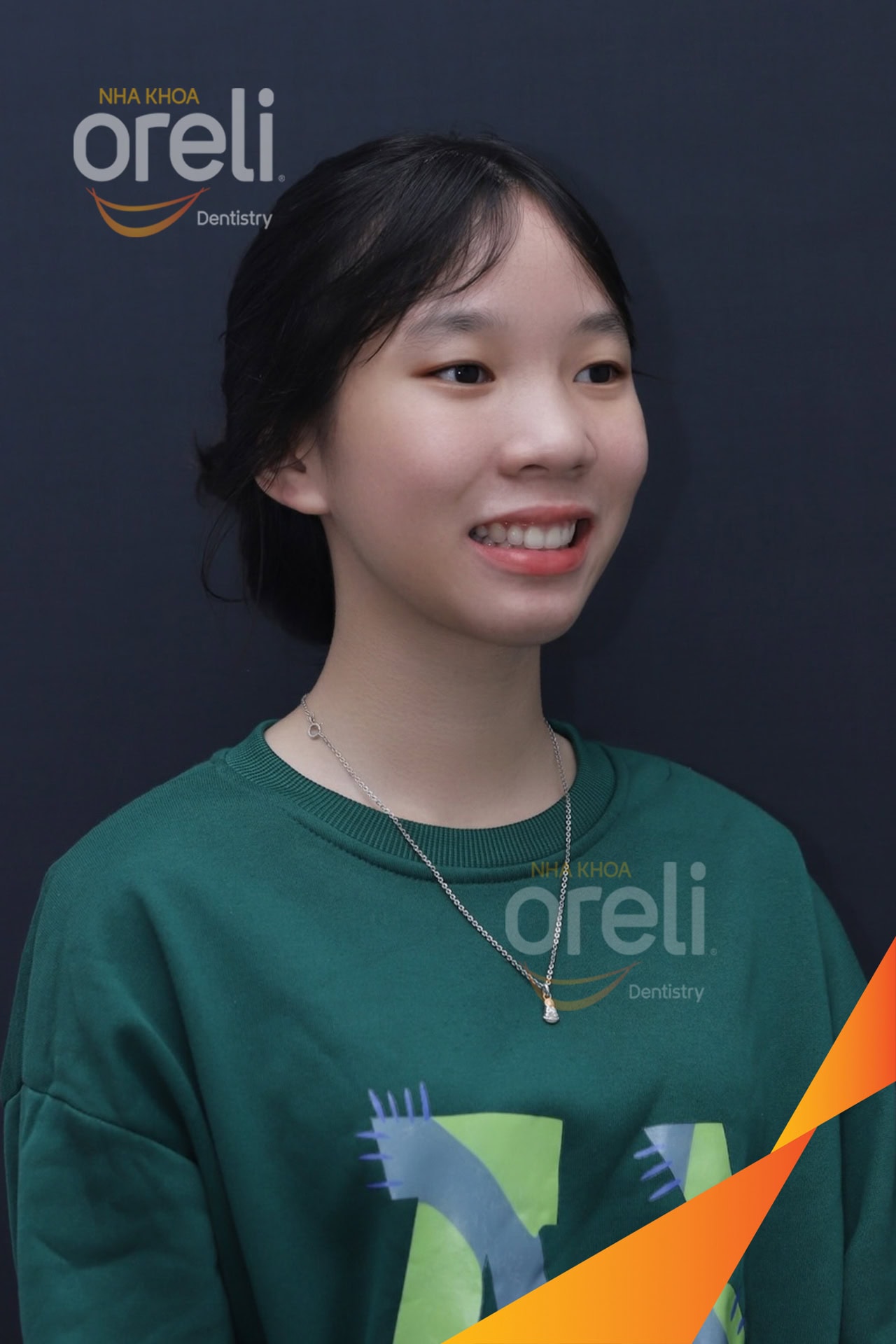 nieng chinh ho uy tin daklak nha khoa Oreli
