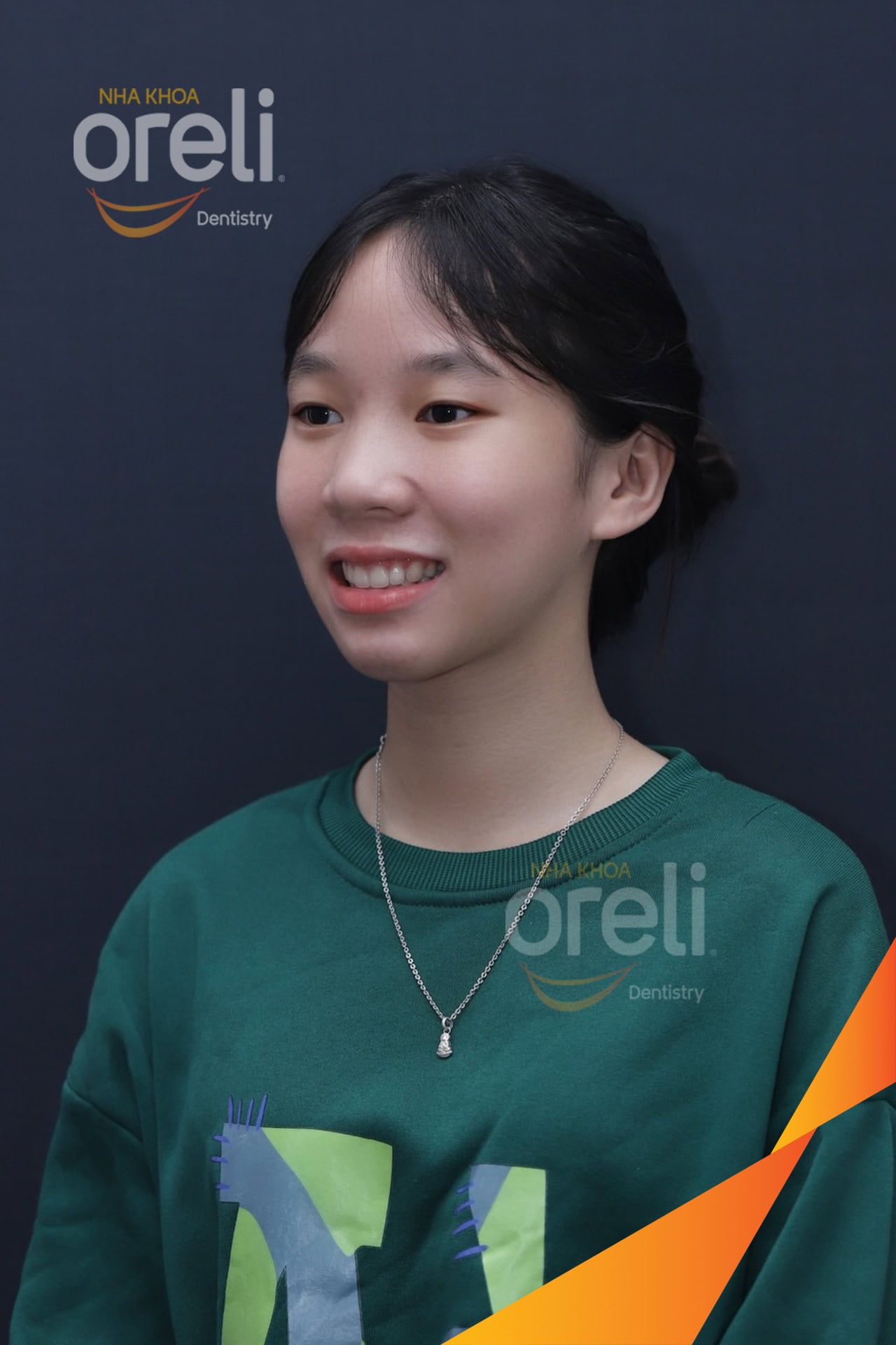 nieng chinh ho uy tin daklak nha khoa Oreli
