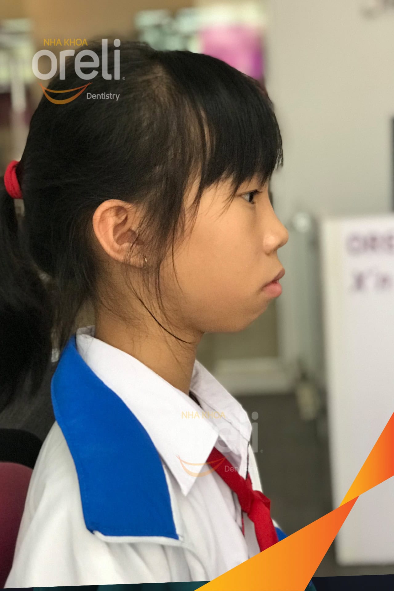 nieng chinh ho uy tin daklak nha khoa Oreli