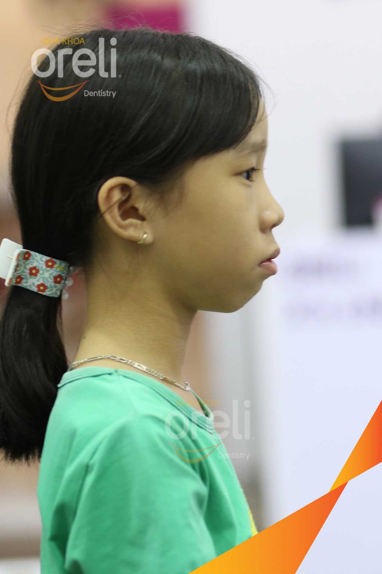 nieng chinh ho uy tin daklak nha khoa Oreli