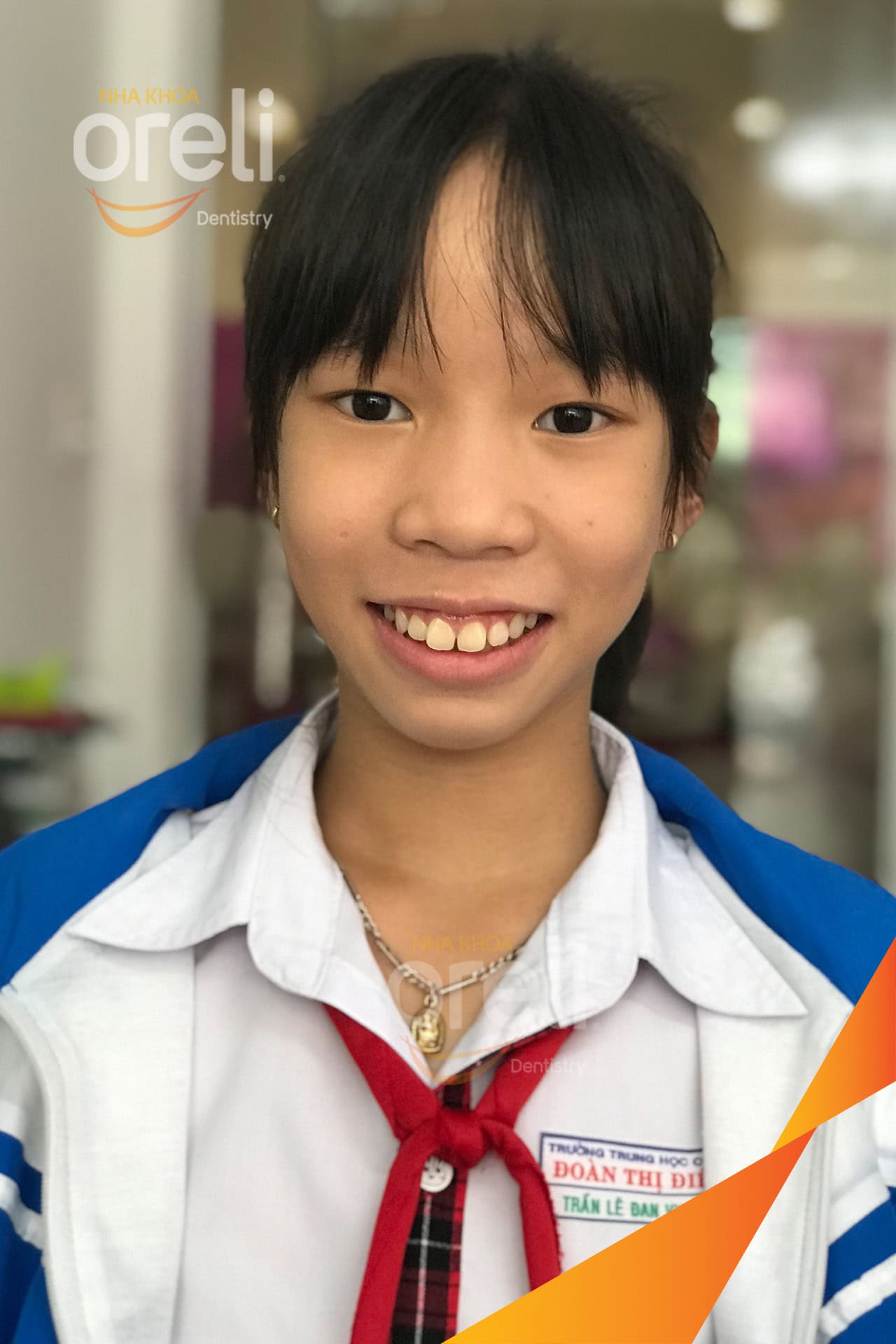 nieng chinh ho uy tin daklak nha khoa Oreli