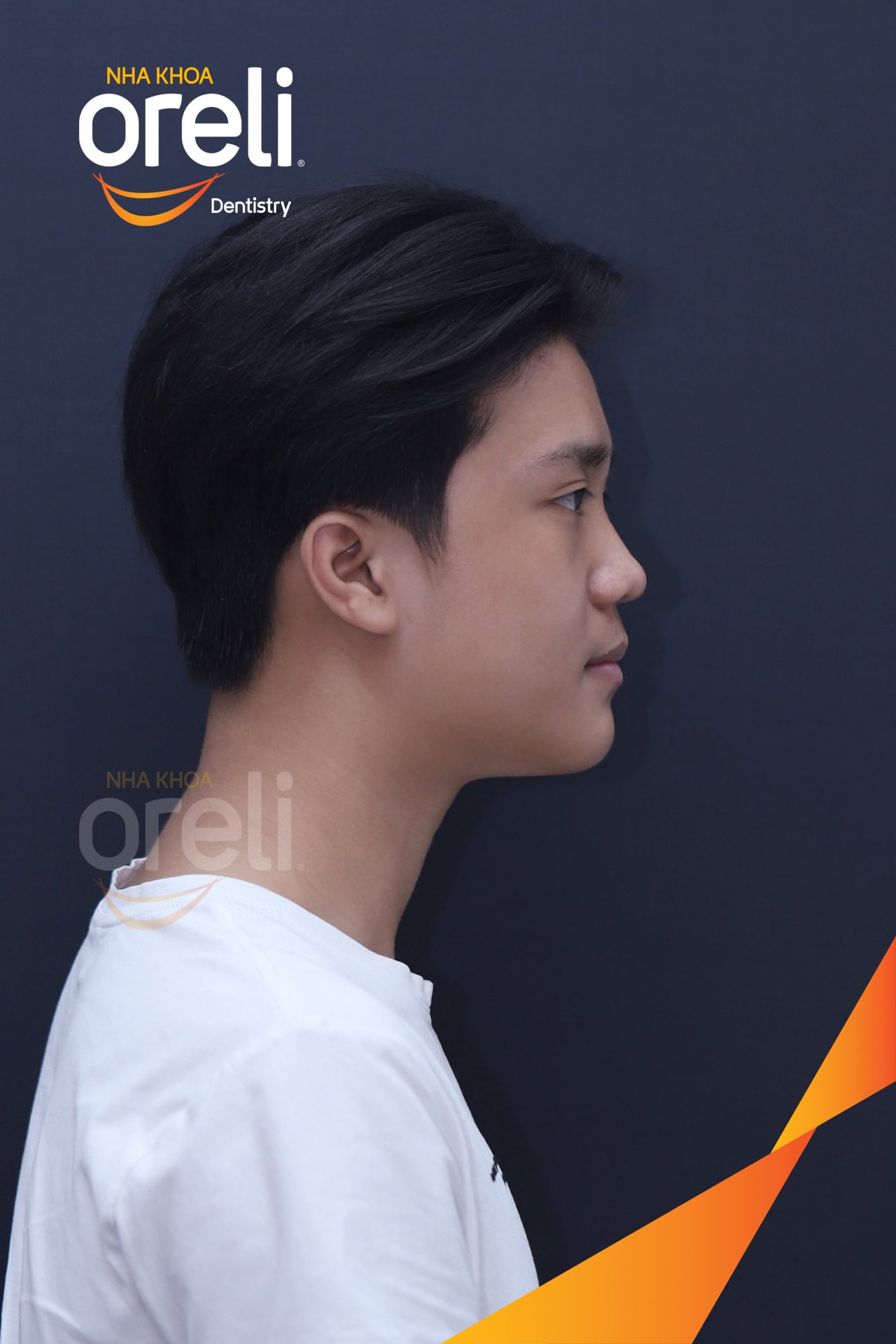 nieng rang chinh chen chuc can sau oreli