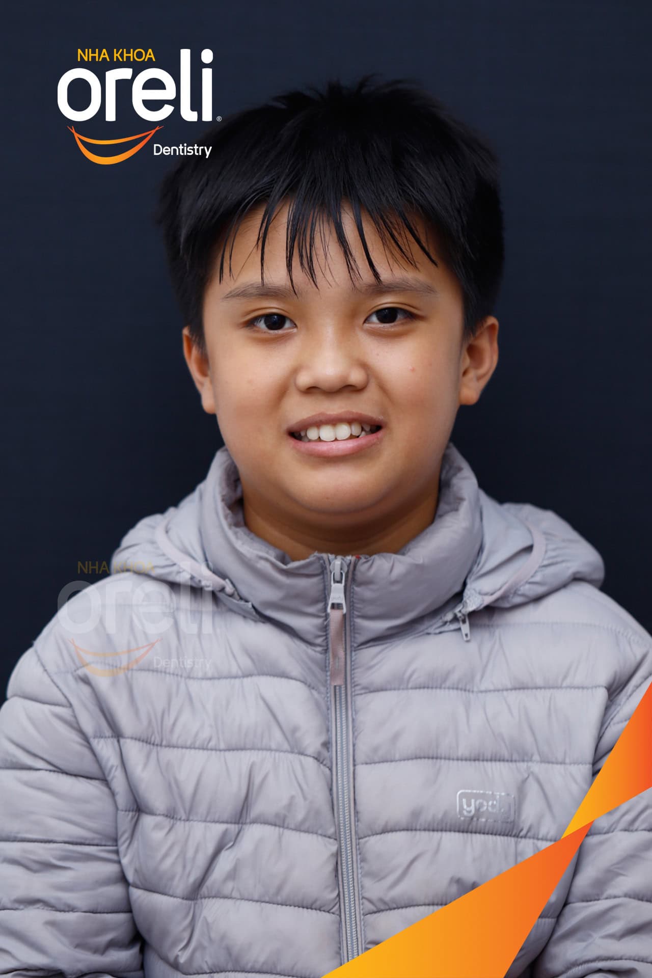 nieng rang chinh chen chuc can sau oreli