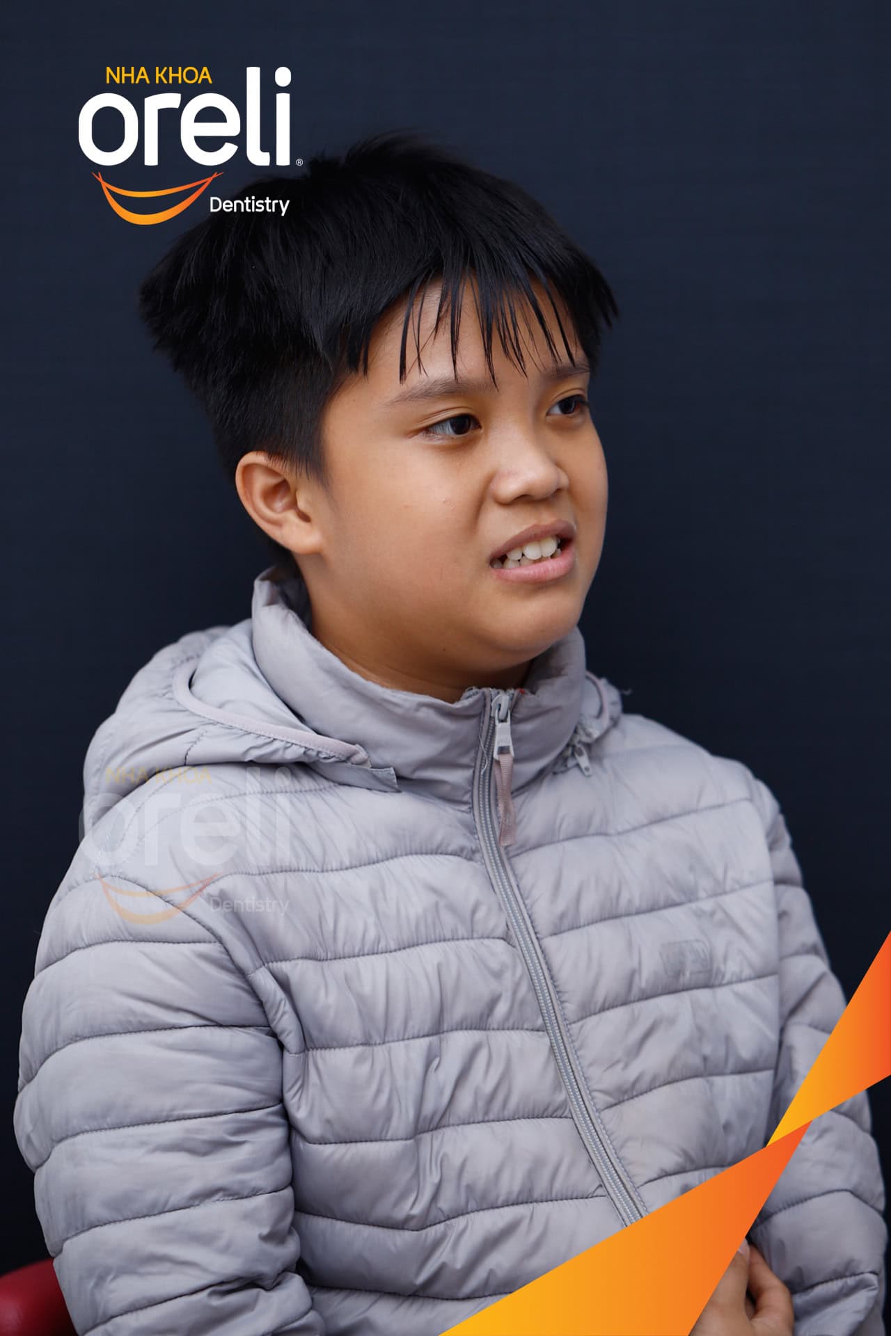 nieng rang chinh chen chuc can sau oreli