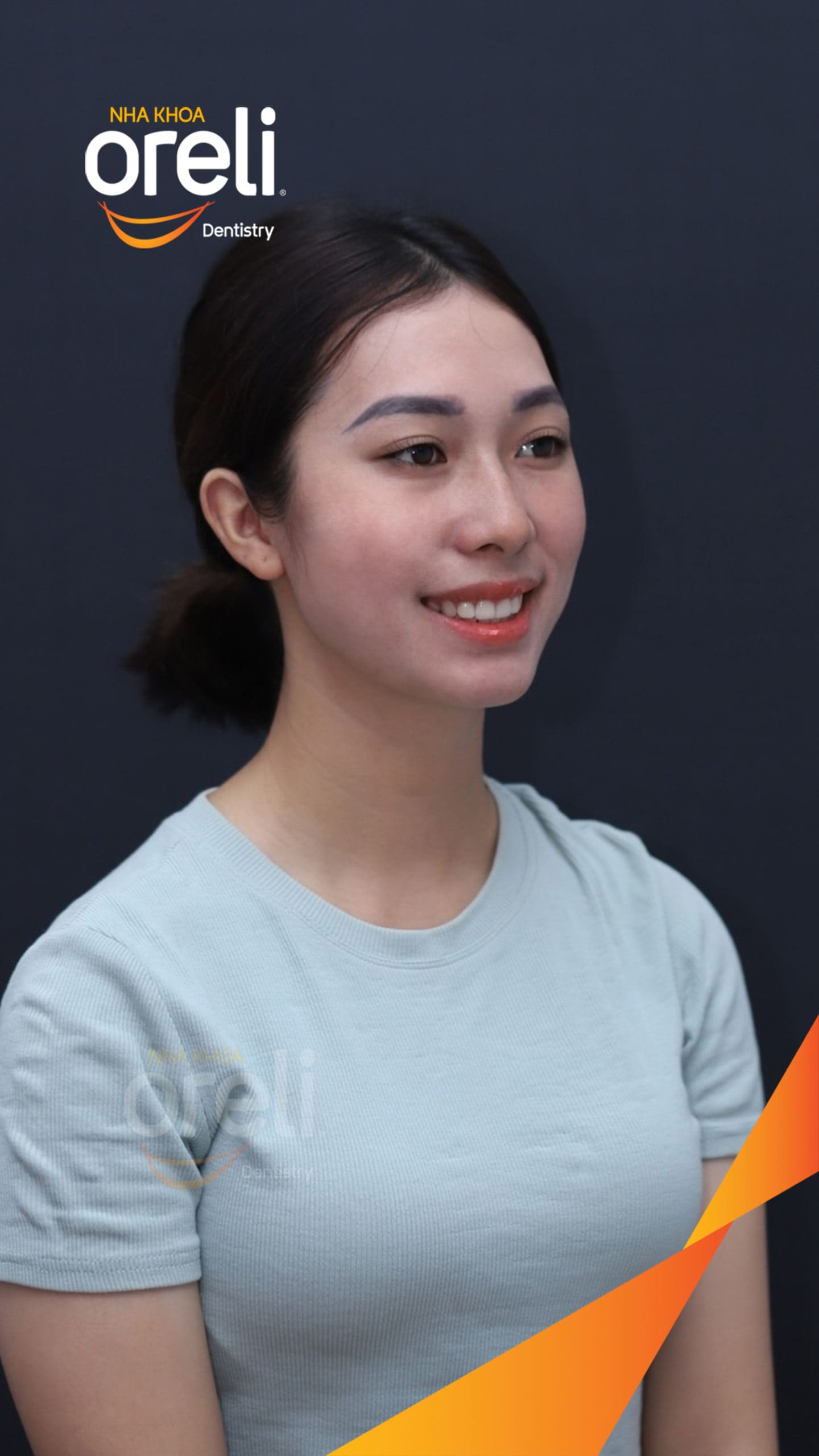 nieng rang chinh ho can sau uy tin nha khoa oreli