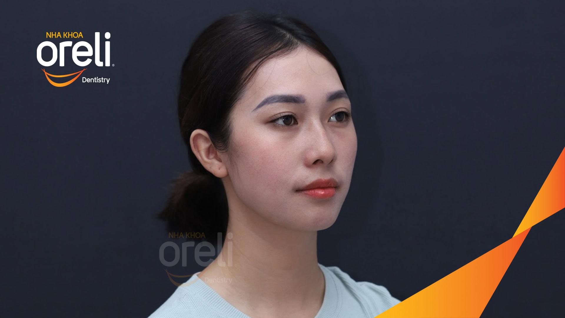 nieng rang chinh ho can sau uy tin nha khoa oreli