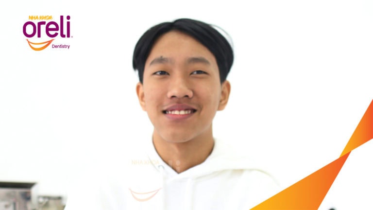 nieng rang chinh lech cam oreli